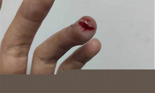 梦到自己手被割破流血(女人梦到自己手被割破流血)-易学网