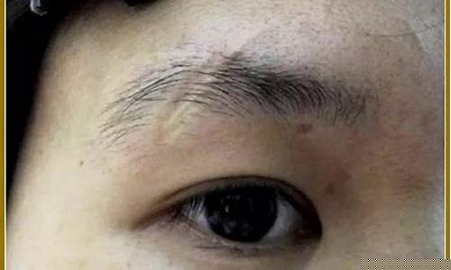 眉毛里有疤痕命运如何(眉毛里面有疤痕面相)-易学网